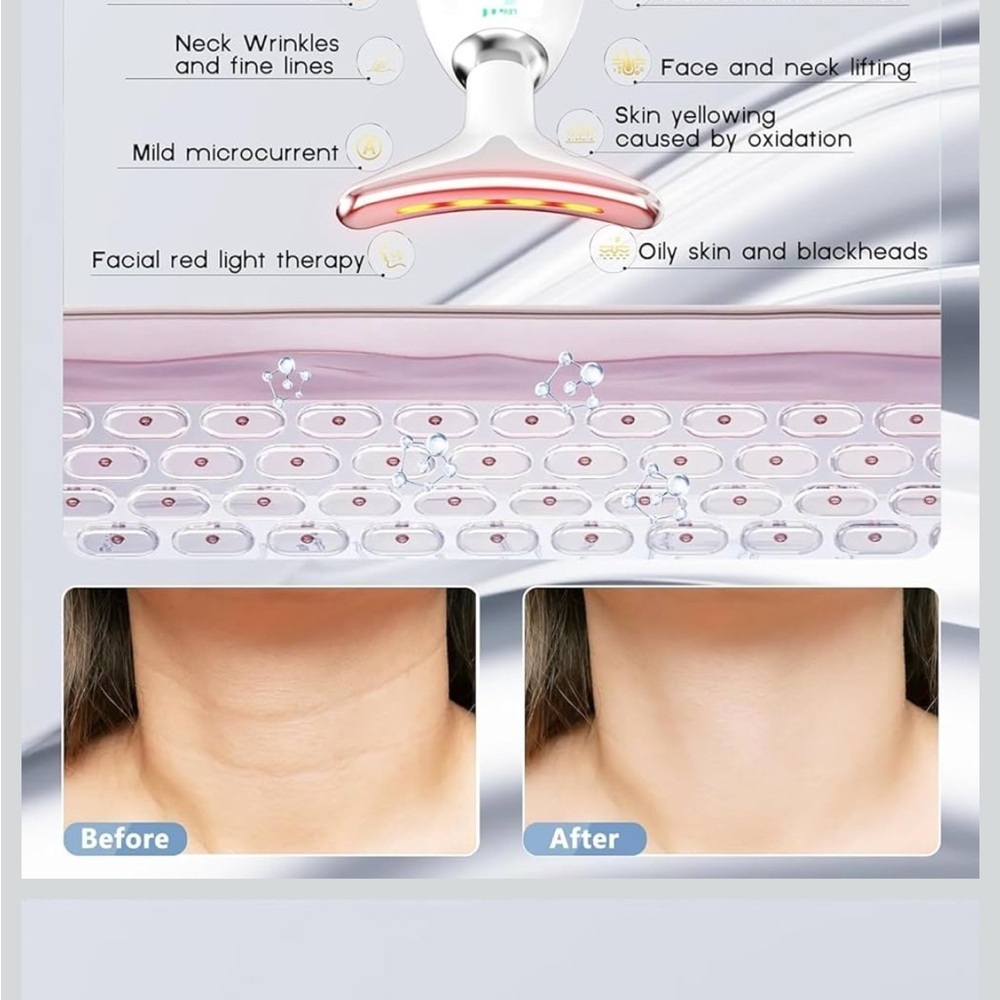 Intense Pulsed Light Wrinkle Reducing Device - Picture 5 of 5